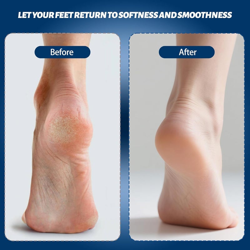 Doeean Electric Feet Foot Callus Remover Equipped with A Vacuum System Foot Scrubber 17 in 1 Professional Foot Care Tool Ipx6 Waterproof Rating for Removing Hard Cracks Dryness and Dead Skin (Black) - Image 3